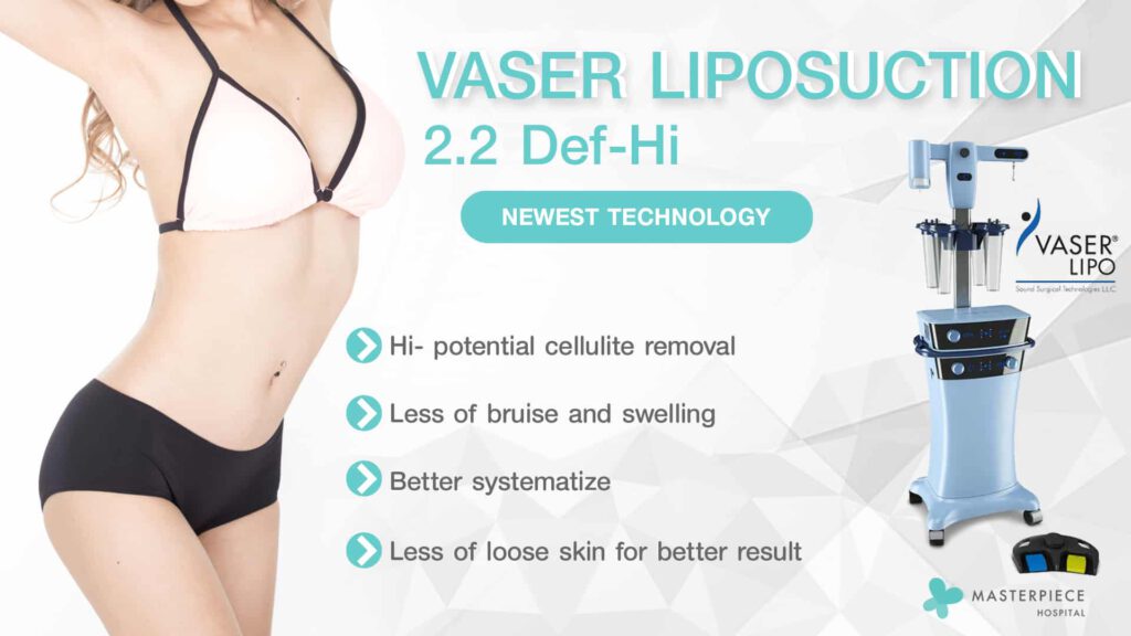 vaser liposuction 2.2 def-hi 