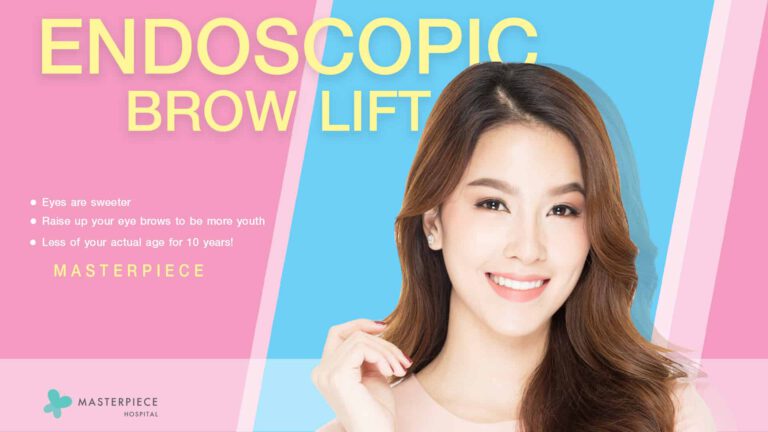 WHAT IS ENDOSCOPIC BROW LIFT ?