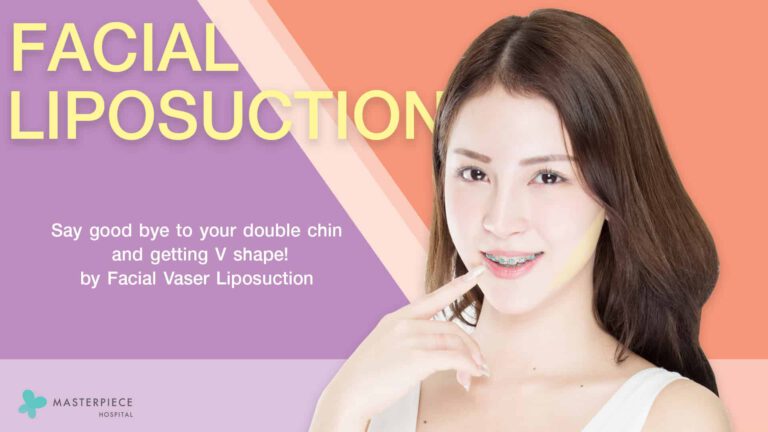 facial liposuction