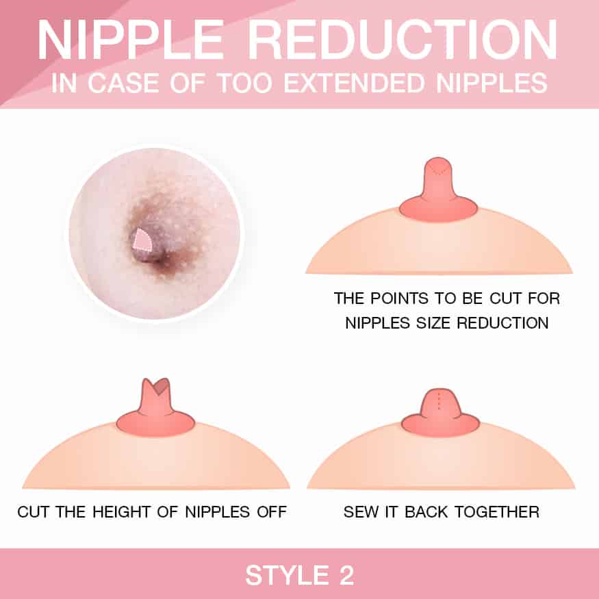 wallpaper Nipple reduction  2