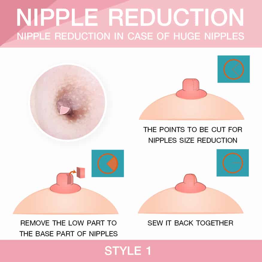 wallpaper Nipple reduction  3