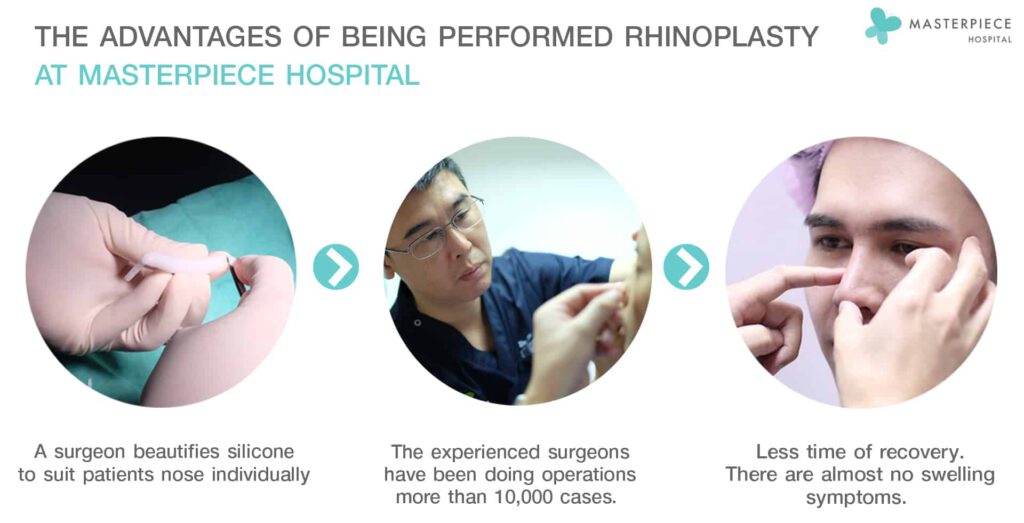 the advantages of being performed rhinoplasty 