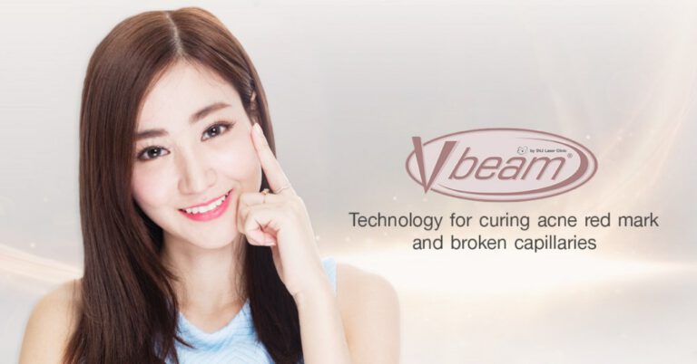 V-BEAM Laser therapy reduce redness from post-surgery