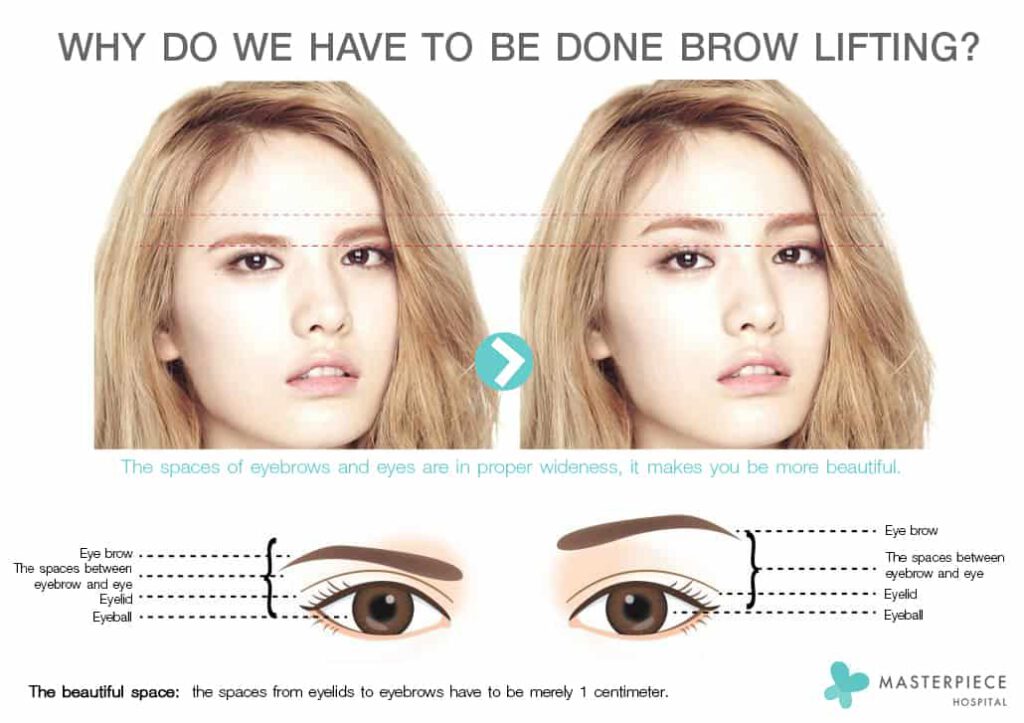 why do we have to be fone brow lifting 
