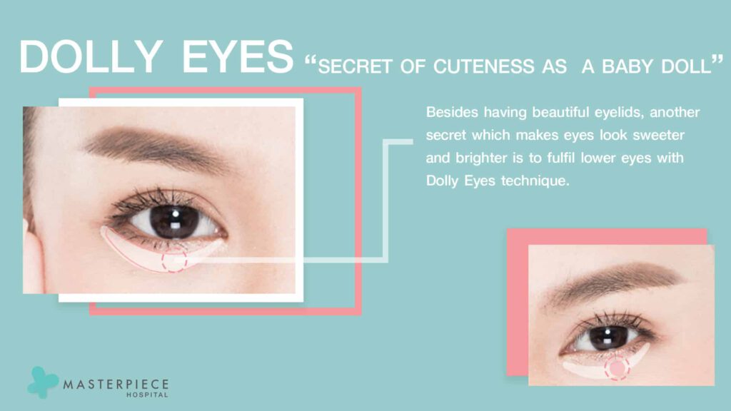 DOLLY EYES PROCEDURE 1