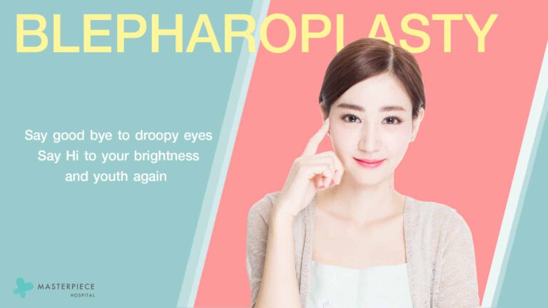 WHAT IS BLEPHAROPLASTYV