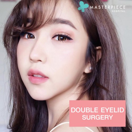 review double eyelid surgery 
