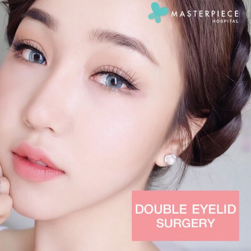 review double eyelid surgery 1
