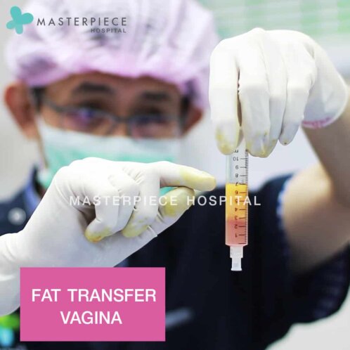 Fat transfer vagina