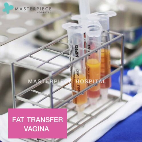 Fat transfer vagina