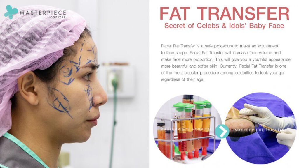 fat transfer secret of celebs&ldols baby face