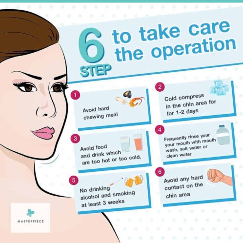 6 step to take care the operation